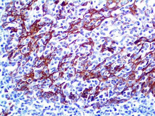 IHC of CD138 EP201 on an FFPE Tonsil Tissue